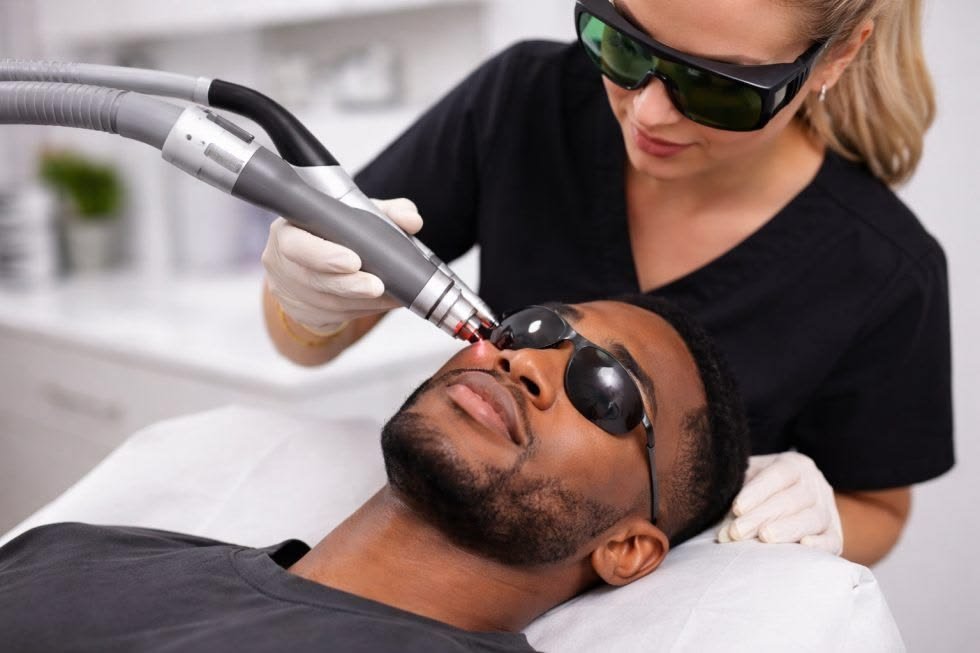 Pigmentation Laser Treatment