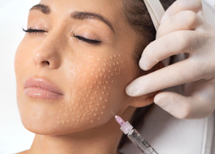 Skin Boosters